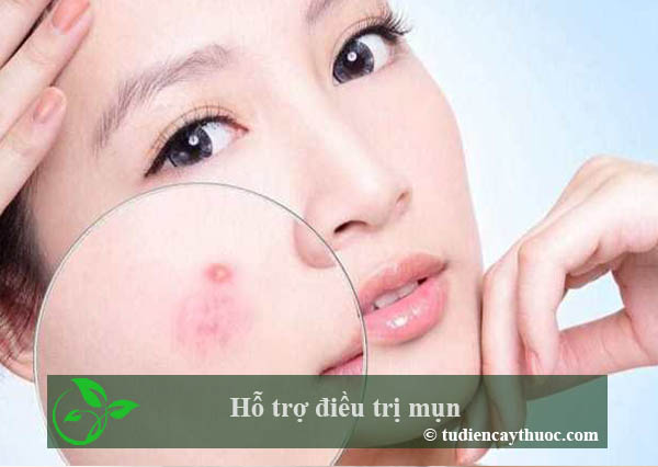 hỗ trợ điều trị mụn