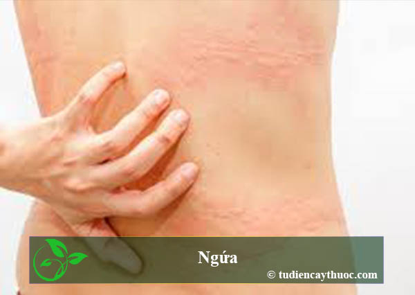 ngứa