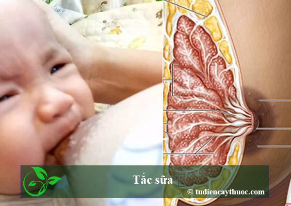tắc sữa tắc sữa