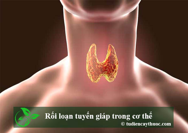 rối loạn tuyến giáp