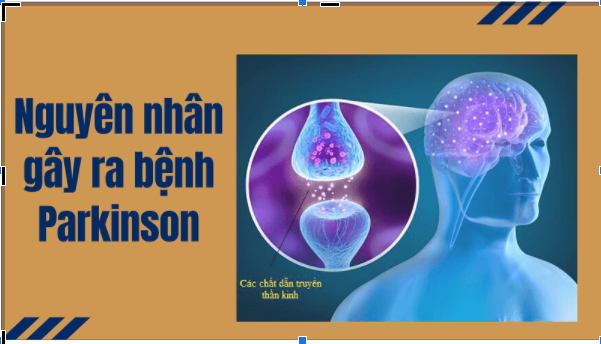 Cách chữa bệnh Parkinson