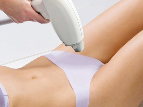 triệt bikini có kiêng quan hệ không